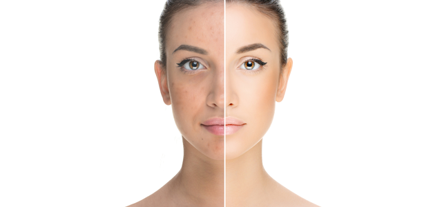 PIGMENTATION