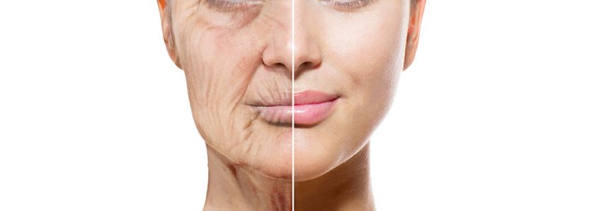 AGEING SKIN