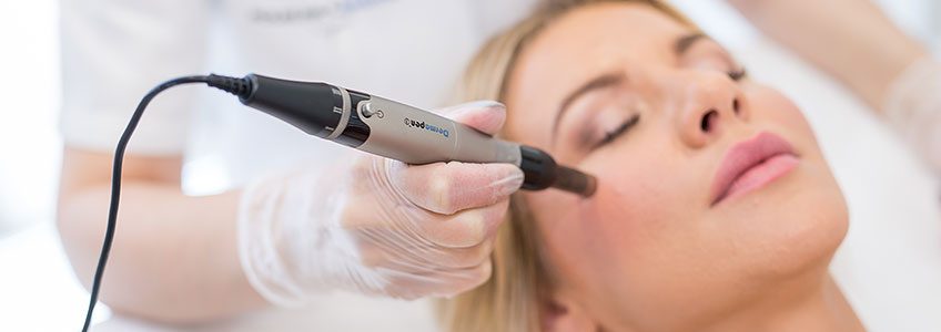 We Answer Your Questions About Micro-Needling
