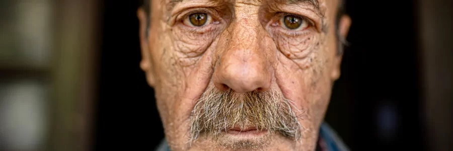 Weathered or unhealthy skin is emerging as a major risk factor for almost every single age-related disease, from Parkinson’s to type 2 diabetes